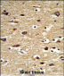 POLG2 Antibody (Center)